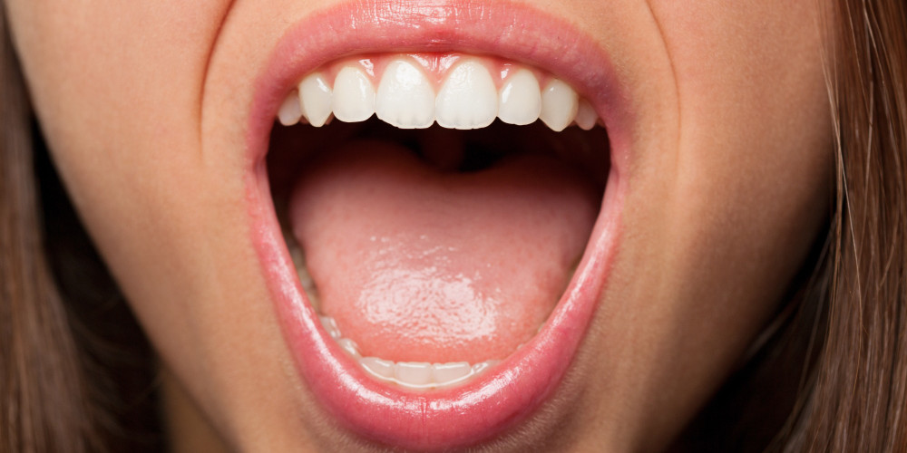 Los signos de la boca que pueden indicar diabetes