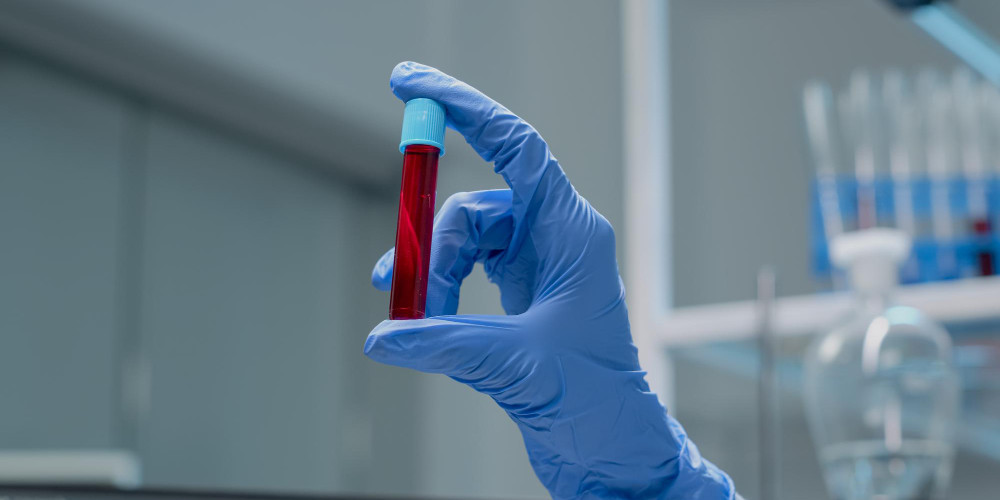 Cáncer y enfermedades crónicas: un test de sangre podría seguir los cambios metabólicos en cada patología

